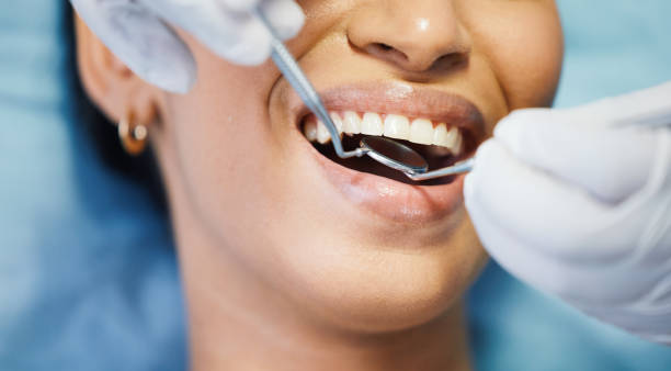Best Emergency Dentist for Knocked-Out Tooth in Three Rivers, OR